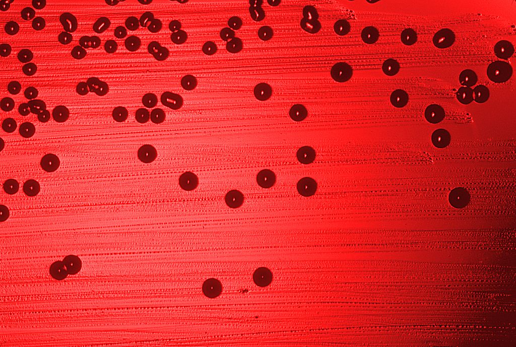 Haemophilus influenzae na płytce z agarem z krwią
